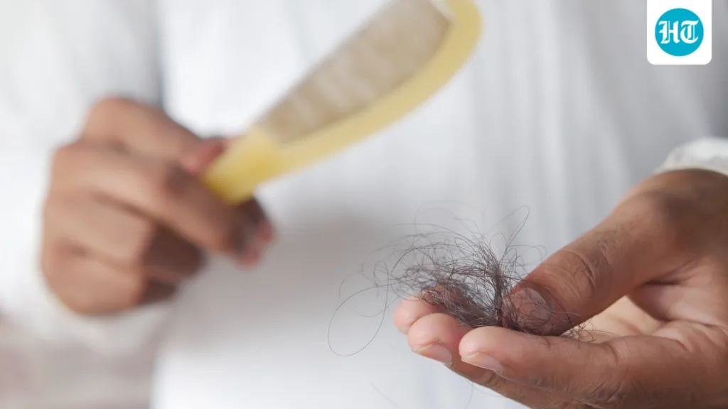 Why can the hair continue to thin after a successful transplant? Cosmetic surgeon explains