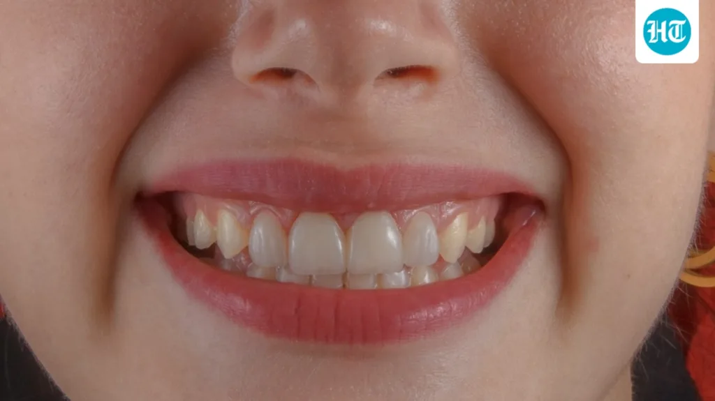 Why do your teeth develop tiny rough edges as you get older? Dentist explains common causes and habits to watch out for Why do your teeth develop tiny rough edges as you get older? Dentist explains common causes and habits to watch out for