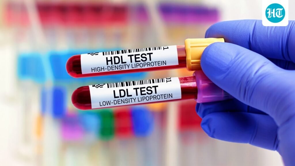 Why is your cholesterol high even though you are slim? A cardiologist explains 6 possible causes beyond weight gain Why is your cholesterol high even though you are slim? A cardiologist explains 6 possible causes beyond weight gain