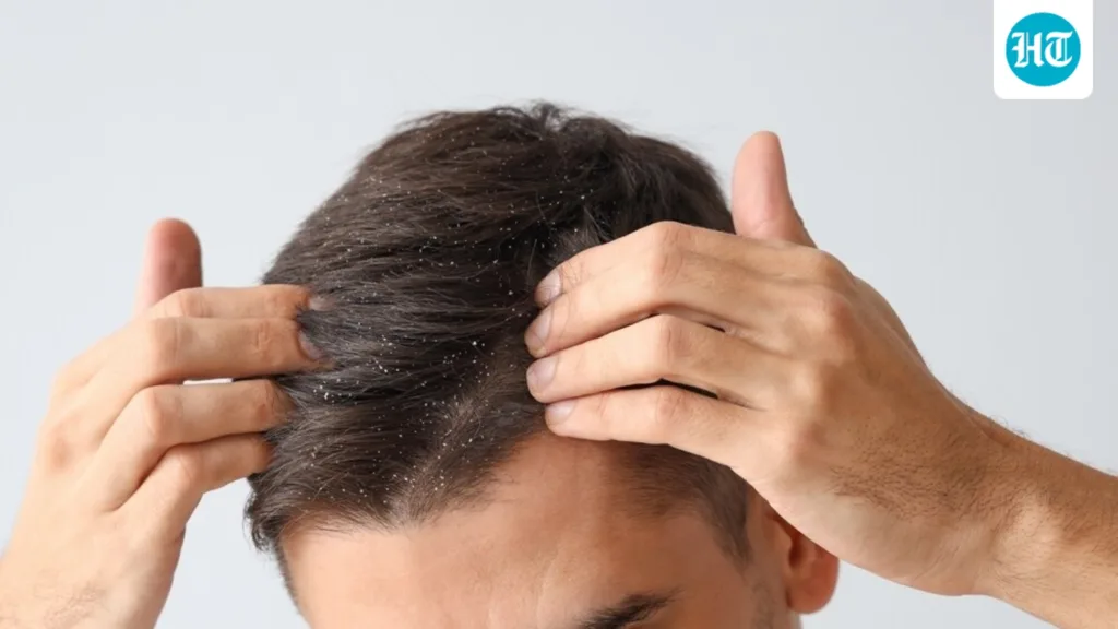 Your hair looks clean, but is your scalp healthy? Dermatologist lists 5 warning signs Your hair looks clean, but is your scalp healthy? Dermatologist lists 5 warning signs